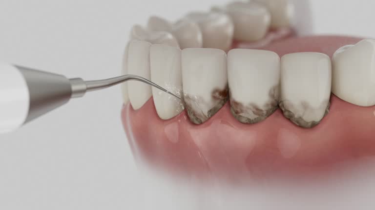 Reliable Tooth Extraction contractor in Atoka County County, OK by Dentist Open Now